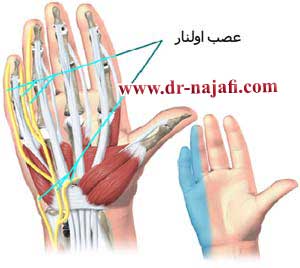 آناتومی آسیب عصب اولنار دست