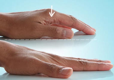 ورزشهای مناسب در ساییدگی دست و انگشتان 4