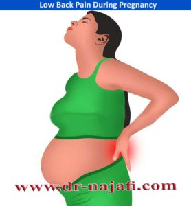درمان کمردرد بارداری