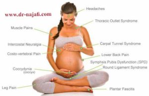 درمان کمردرد بارداری