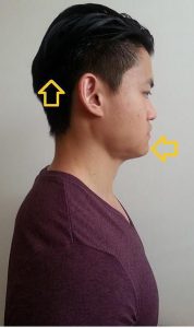 انقباض عضلات گردن (چین تاک)