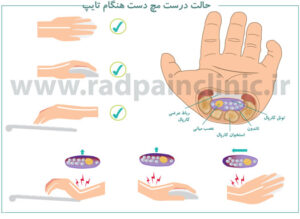 درمان های خانگی درد مچ دست