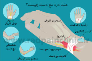 مچ درد ، علت درد مچ دست ، درمان مچ درد