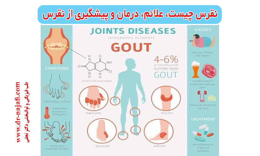 نقرس چیست