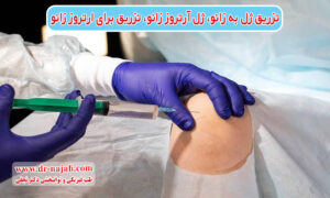 تزریق ژل به زانو